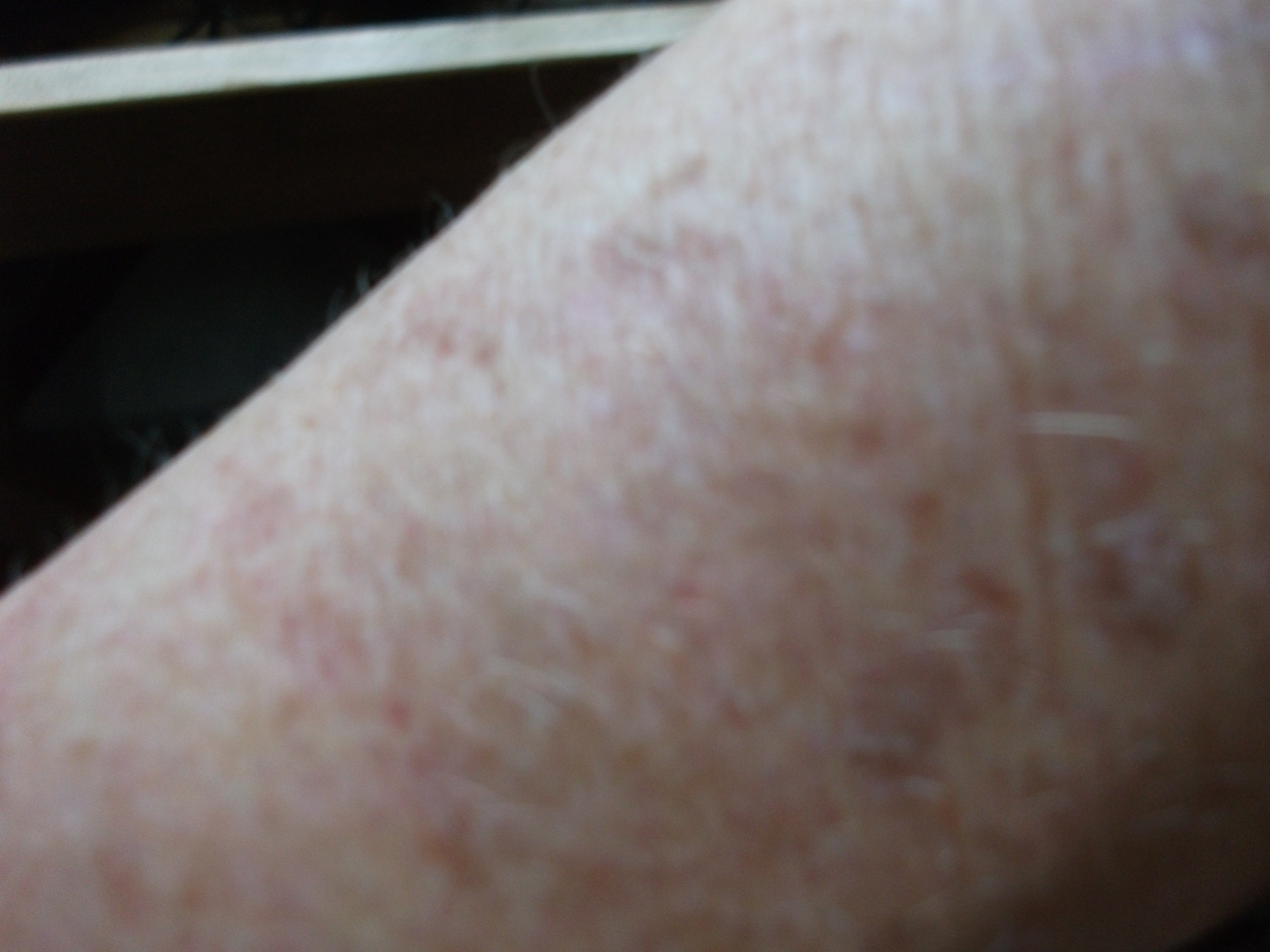 Image from report NUFORC_186678