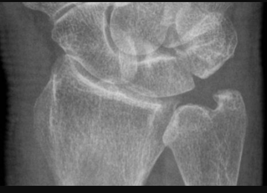 Image from report NUFORC_186678